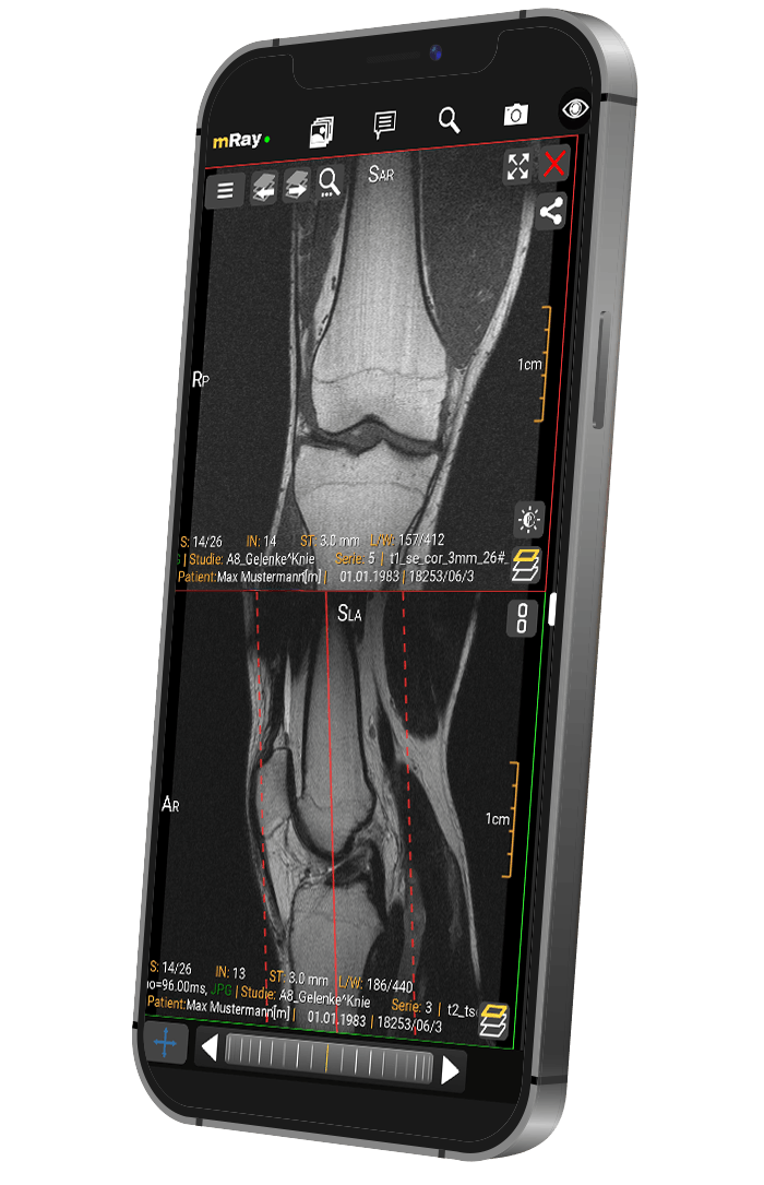 Mobile_Mockup_Knie (1)