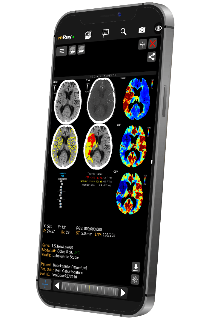 Mobile_Mockup_VEOcore_ASPECTS (1)